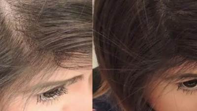 خلطة طبيعية لنمو الشعر