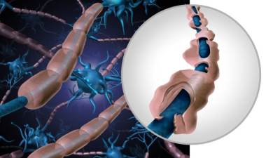 دراسات حديثة حول مرض التصلب العصبي المتعدد