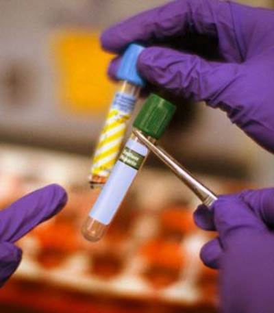 لقاح جديد للوقاية من مضاعفات الدرن الرئوي