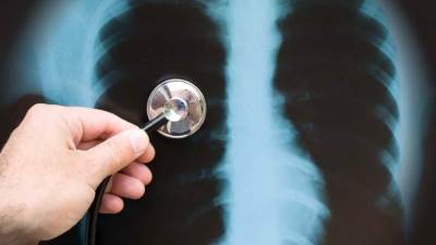 الدليل الكامل لفوائد التطعيم الواقي من الالتهاب الرئوي