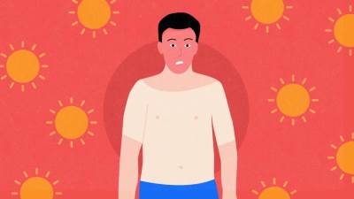 عالجي حروق الشمس من محتويات ثلاجتك