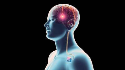 تحفيز الدماغ البشري كهربائيا .. ما المضار والمنافع؟