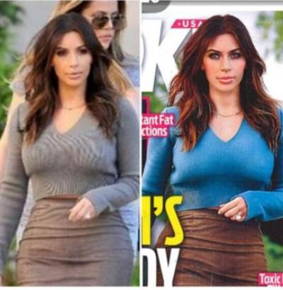 هل حقنت كيم مؤخرتها بالدهون؟