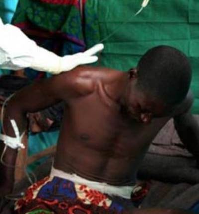 مرض «إيبولا» يستمر في حصد الأرواح .. ويؤثر سلبا على اقتصادات غرب أفريقيا