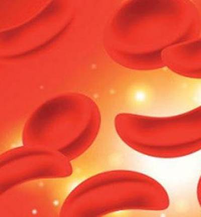 أمل جديد لمرضى الخلايا المنجلية