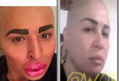 بالصور : شاب أنفق 150 ألف دولار ليشبه كيم كاردشيان فأصبح يشبه "إلهام شاهين"