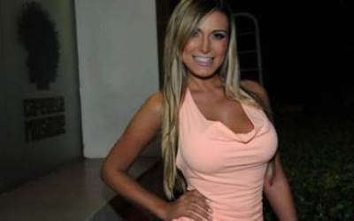  بالصور .. تعرف على ماحدث لعارضة الأزياء عقب عمليات التجميل !!