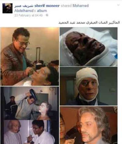 لأول مرة .. شريف منير يكشف عن المتسبب في تشوه وجهه