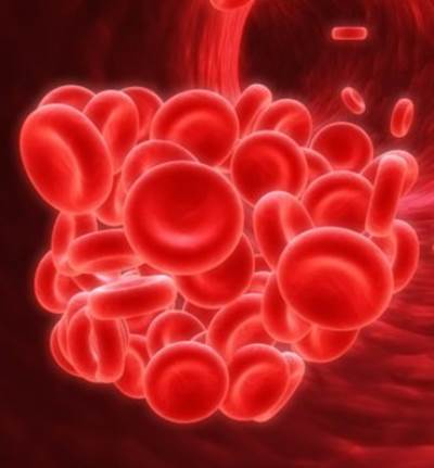 التخثرات الدموية .. حالة مرضية قاتلة