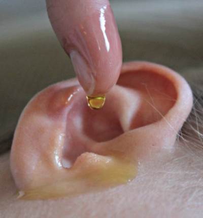  تخلص من شمع الأذن وعدواها بعلاج منزلي بسيط