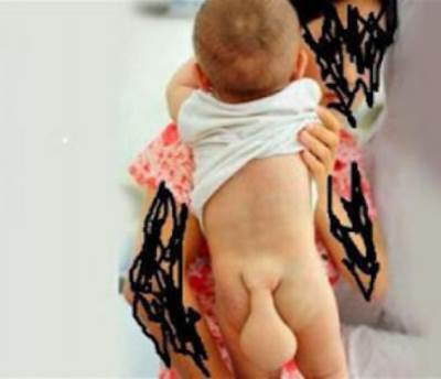 طفل مولود بذيل