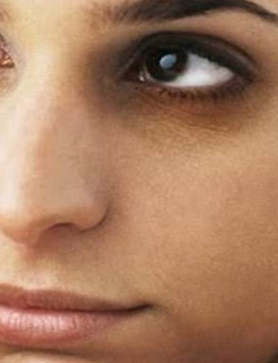 كيف تقضين على الهالات السوداء فى الصيف