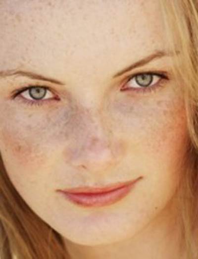 ماسك "الخيار" لعلاج النمش والكلف والبقع