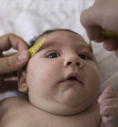 ماهى خطورة فيروس زيكا .. وعوامل انتشارة؟