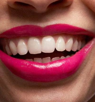 احذر هذه العادات تدمر أسنانك