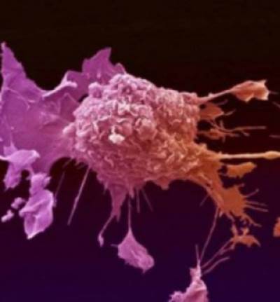 كثرتُها... قد تسبّب السرطان!