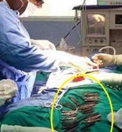 دخل إلى المستشفى بحالة طارئة.. وما وجدوه في معدته أدهشهم!