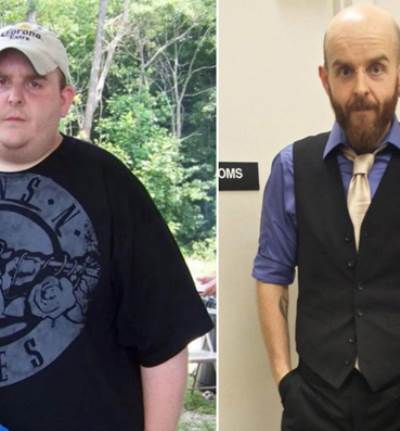 صور لشاب فقد أكثر من 130 كيلوجرام من وزنه ويريد الاحتفاظ بالجلد المترهل .. فما السبب؟!