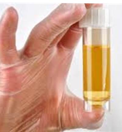 دراسة: اختبار للبول يعطي أدلة حول صحة الجنين 