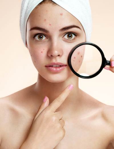 ما السبب في ظهور حب الشباب العشوائي؟