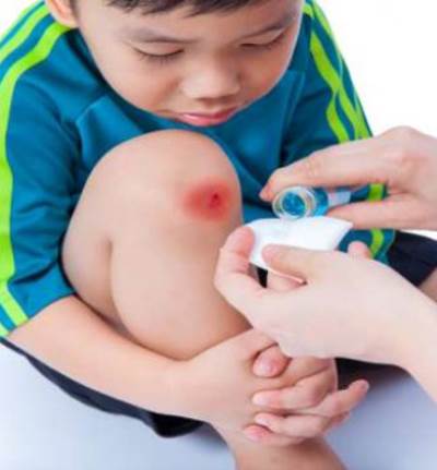 لا تطهرى الجروح بالكحول لهذا السبب !!