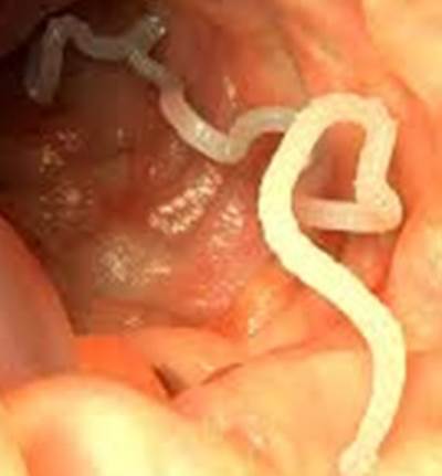 انتبهى .. أطعمة تتناوليها يوميا تسبب ديدان الدماغ