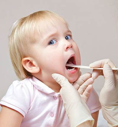 ماهي حصوات لوزتي الحلق والمخاطر الناتجة عنها؟