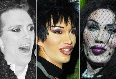 بالصور .. أسوأ عمليات تجميل شوهت أصحابها المشاهير