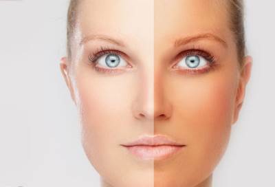 علاجات منزلية لإزالة تصبغات الشمس ونصائح لحماية نفسك من أضرار أشعتها