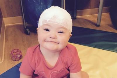 "معجزة" تنقذ طفلة فقدت ابتسامتها