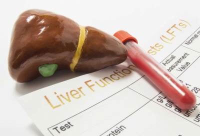 اسباب ارتفاع انزيمات الكبد