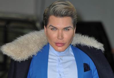 "الرجل الدمية" أزال 4 أضلاع من جسده بعد 44 عملية تجميل