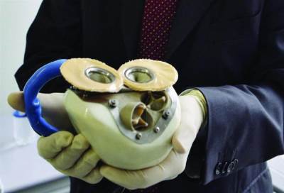 "القلب الفضائي" ابتكار صيني لاستبدال القلوب المريضة