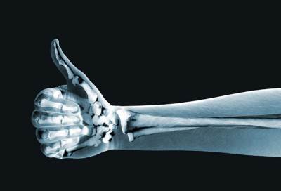 زيادة استهلاك البروتينات يُحسن صحة العظام