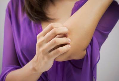 قرصات البعوض .. معاناة عالمية