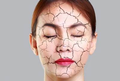 أعراض الجفاف فى رمضان ونصائح للوقاية منه 