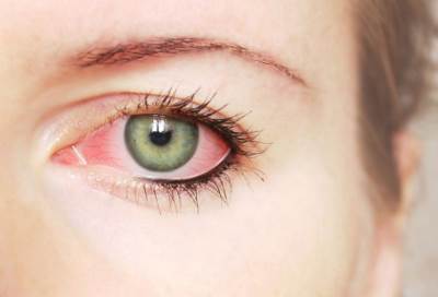 التعرض المستمر لعوادم السيارات يزيد فرص الإصابة بالعمى