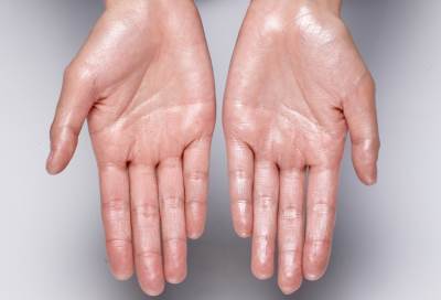 الضغط النفسى يؤدى للإصابة بإكزيما خلل التعرق