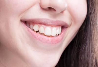 كيف تجرى عمليات زراعة الفكين .. ومتى تصبح ضرورة حتمية؟