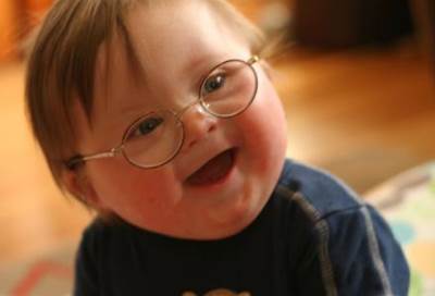 لماذا يعاني الأشخاص أصحاب الإعاقة الذهنية من انخفاض متوسط العمر المتوقع؟