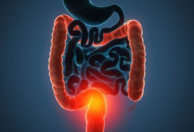 اكتشاف بروتين يحفز نمو سرطان الأمعاء والقولون