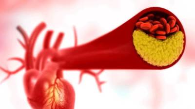 لمحاربة الكوليسترول .. حيل سريعة للحفاظ على الشرايين