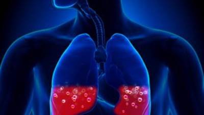 أعراض وعلاج الانسداد الرئوى