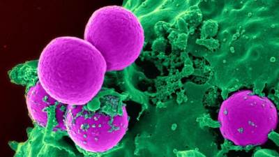 التجلطات الدموية والأنيميا السبب في وفاة مرضى كورونا .. إليكِ التفاصيل