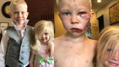 أخ ينقذ أخته ويقول : "اذا كان هناك شخص سيموت فيجب أن اكون أنا" .. إليكِ التفاصيل