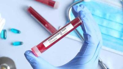 تطوير اختبار جديد للكشف عن كورونا فى دقائق .. إليكِ التفاصيل