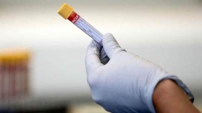 خبر سار .. الهند تحصل على اللقاح الأول ضد كورونا بحلول نوفمبر المقبل