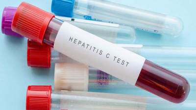 دراسات حديثة تؤكد فعالية أدوية فيروس C فى تحسين حالة مصابى كورونا .. إليكِ التفاصيل