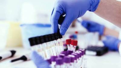 بدء شحن عقار كورونافير لعلاج فيروس كورونا .. إليكِ التفاصيل