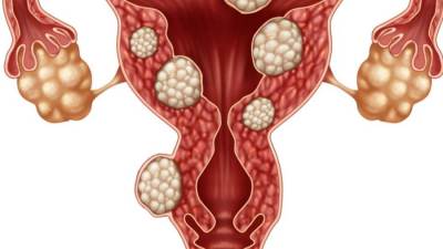 علماء روس يبتكرون مادة تزيد من فعالية العلاج الكيميائى لسرطان الرحم .. إليكِ التفاصيل